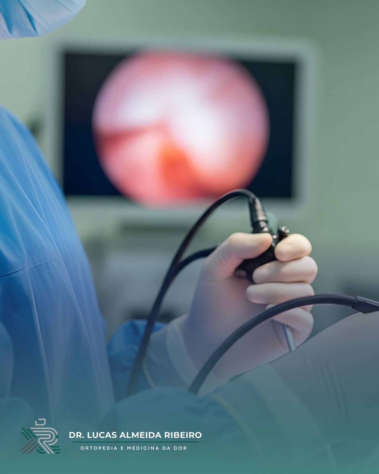 Endoscopia de coluna